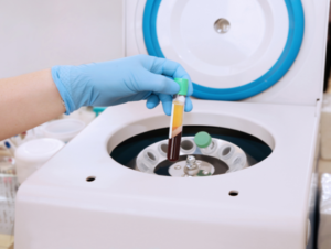 Infusionstherapie zur Ausleitung von Toxinen in der integrativen zahnarztpraxis Dr. Dilaver in Mainz - ganzheitliche Zahnmedizin und metallfreier Zahnersatz"